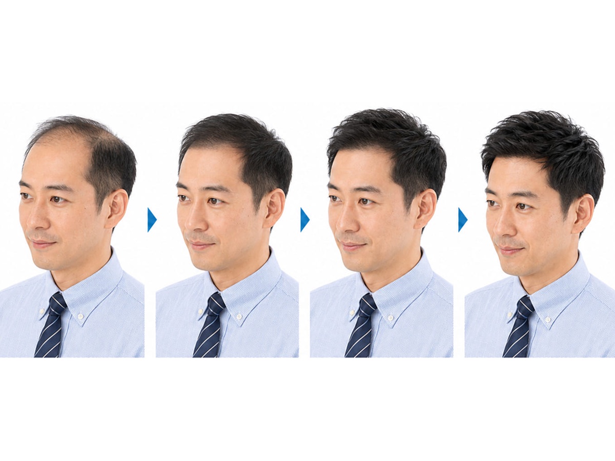 ステップ増毛のイメージ